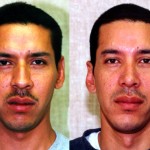 Male Rhinoplasty Before & After Patient #6401