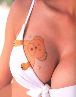 Gummy Bear Breast Implants in New York