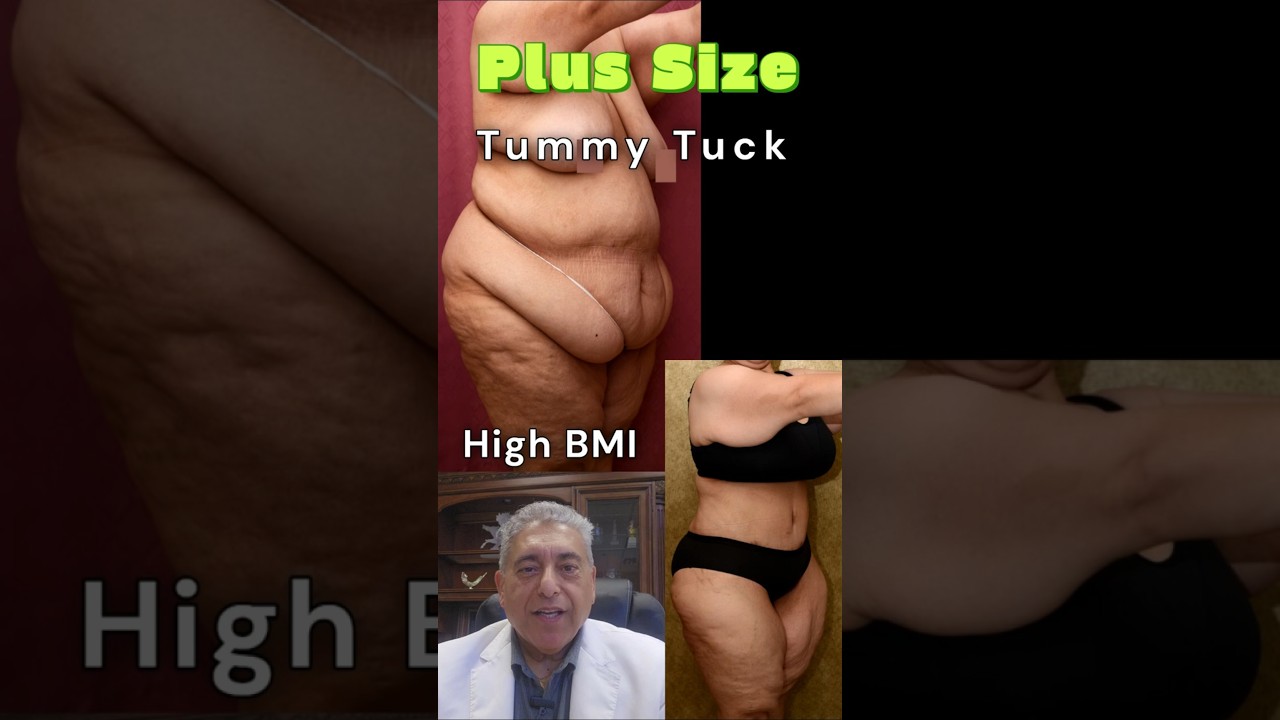 Video 1