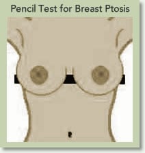 How to do the discount pencil test for breasts